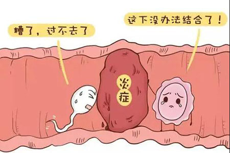 藥流自己在家吃藥行不行