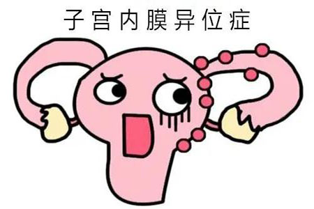 盆腔炎會引起不孕嗎深圳羅湖哪里可以治