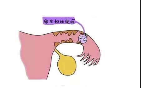 需要做什么檢查才能排除宮頸癌