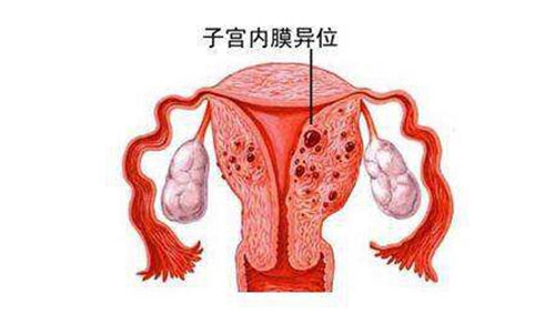 深圳女性尿道炎都有哪些癥狀