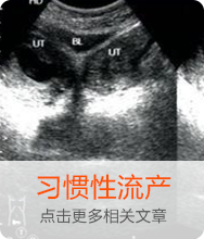 習(xí)慣性流產(chǎn)
